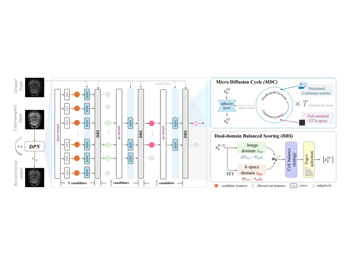 Breaking the Continuum: Discrete Distribution Learning for Structural MRI Reconstruction